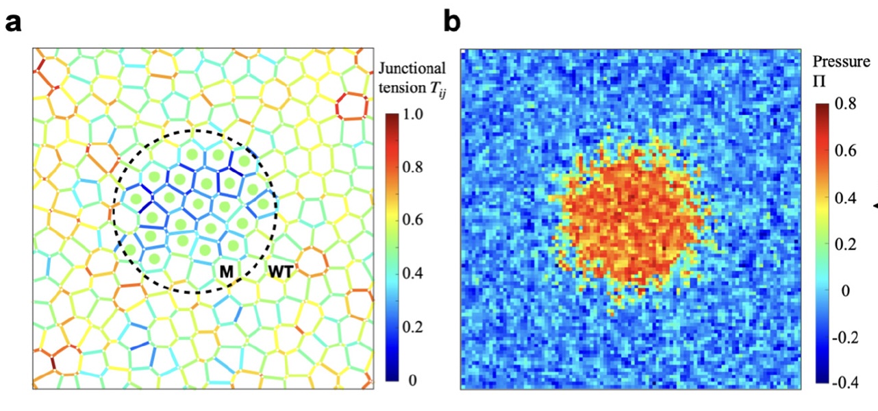 Physics of cancer - tissue mechanics